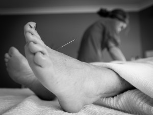 This image is of acupuncture in Buderim on the Sunshine Coast 